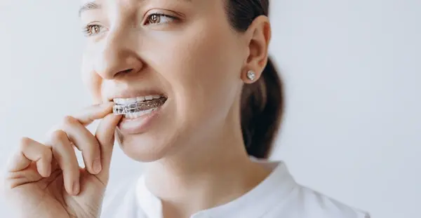 orthodontics in cliffcrest scarborough