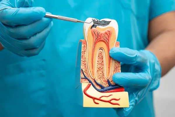 root canal treatment in cliffcrest scarborough
